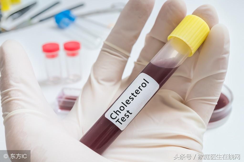 糖尿病的成因，深度解析其背后的原因，深度解析糖尿病成因，揭示背后原因真相