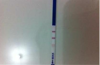 胎停育前兆分泌物圖片及其相關(guān)信息解讀，胎停育前兆分泌物圖片詳解及信息解讀指南