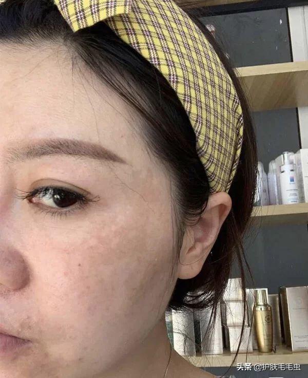 怎樣有效的淡化黃褐斑——全方位美白祛斑攻略，全方位美白祛斑攻略，如何有效淡化黃褐斑