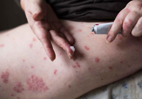 鼻咽癌前期的18種預兆及其重要性，鼻咽癌前期的18種預兆與重要性解析