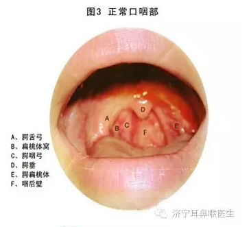 慢性咽炎三天斷根，真相還是幻想？，慢性咽炎三天斷根，真相還是幻想？揭秘治療真相。