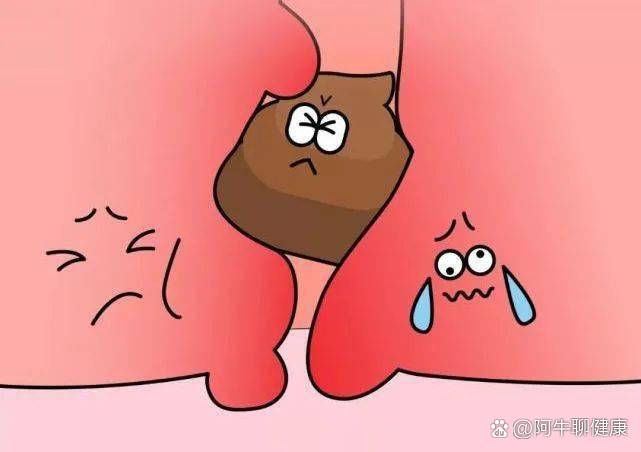 肛門口堵了一坨干硬的大便怎么辦？——便秘的解決方法與預(yù)防策略，解決便秘難題，肛門口干硬大便堵塞的解決方法與預(yù)防策略