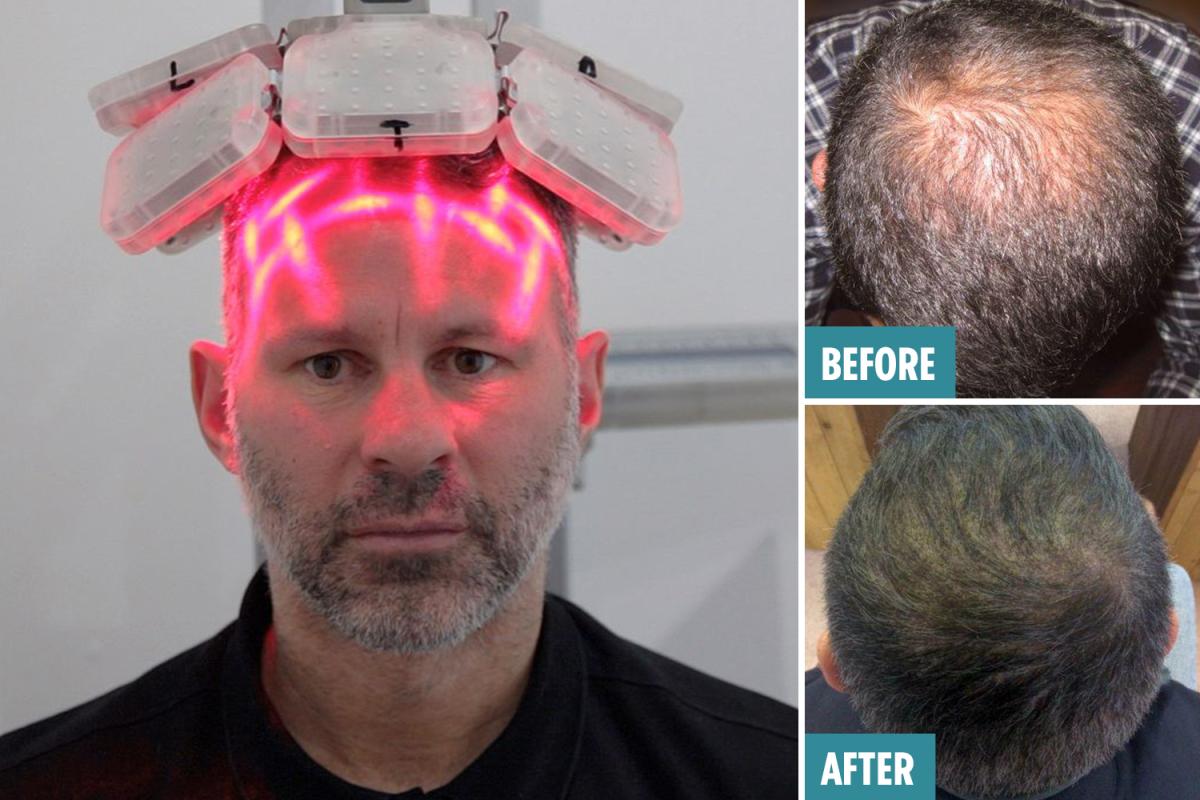 激光手術(shù)費(fèi)用詳解，多少錢一次？，激光手術(shù)費(fèi)用全面解析，手術(shù)費(fèi)用究竟是多少？