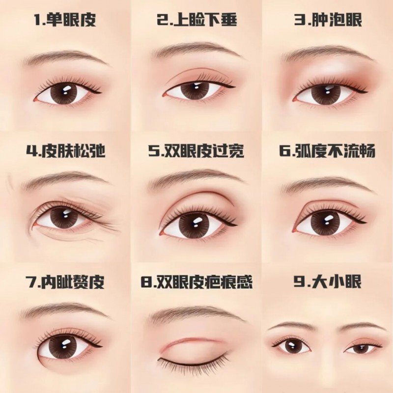 雙眼皮下垂怎么解決——專業(yè)方法與日常護(hù)理建議，雙眼皮下垂解決方法，專業(yè)方法與日常護(hù)理指南