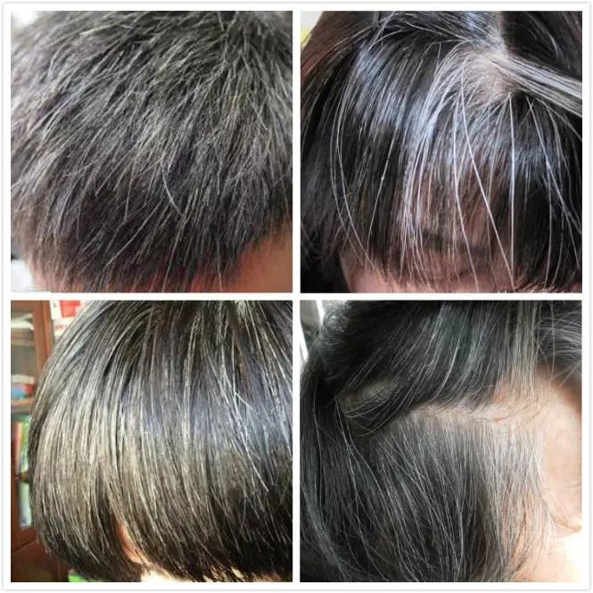 葉酸能讓白頭發(fā)變黑嗎，探究真相與科學解析，葉酸能否讓白頭發(fā)變黑？真相與科學解析探究