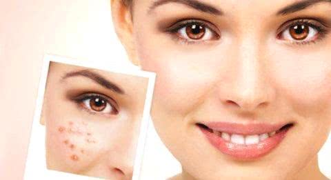 臉上長斑的原因及其影響因素，深度解析，深度解析，臉上長斑的原因及其影響因素