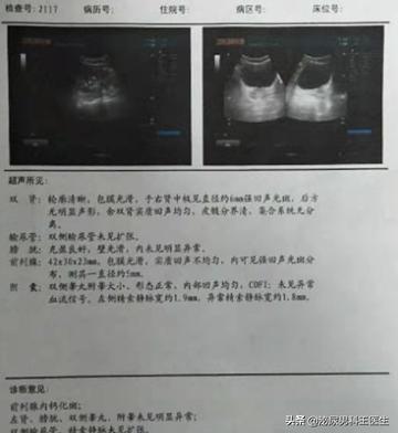 關(guān)于年輕男性前列腺鈣化，了解、應對與關(guān)愛，年輕男性前列腺鈣化，認知、應對與關(guān)愛之道
