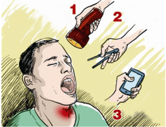 魚刺卡喉嚨自救有妙招，魚刺卡喉自救技巧大揭秘