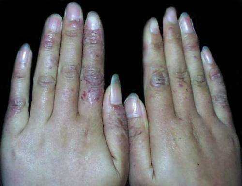 熱點(diǎn) 第5頁